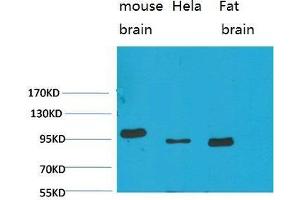 Western Blot (WB) analysis of 1)Mouse Brain Tissue, 2)HeLa, 3)Rat Brain Tissue with EphA1 Rabbit Polyclonal Antibody diluted at 1:2000. (EPHA1 anticorps)