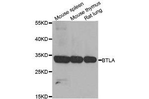 Western blot analysis of extracts of various cell lines, using BTLA antibody. (BTLA anticorps  (AA 31-241))
