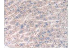 IHC-P analysis of Mouse Liver Tissue, with DAB staining. (DDX58 anticorps  (AA 1-211))
