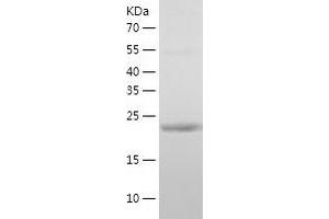 Western Blotting (WB) image for Casein beta (CSN2) (AA 16-226) protein (His tag) (ABIN7122156)