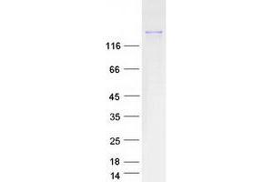 Validation with Western Blot