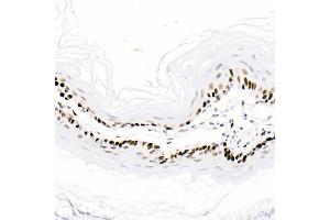 Immunohistochemistry of paraffin-embedded mouse esophagus using PCNA antibody (ABIN6133630, ABIN6139020, ABIN6139022 and ABIN7101400) at dilution of 1:2700 (40x lens). (PCNA anticorps)