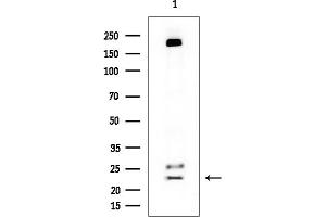 anti-Guanylate Cyclase Activator 1A (Retina) (GUCA1A) antibody