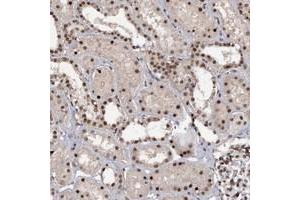 Immunohistochemical staining of human kidney with TBC1D12 polyclonal antibody  shows strong nucelar positivity in cells in tubules. (TBC1D12 anticorps)