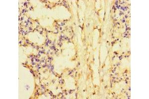 Immunohistochemistry of paraffin-embedded human lung tissue using ABIN7169732 at dilution of 1:100 (SMCO1 anticorps  (AA 82-214))