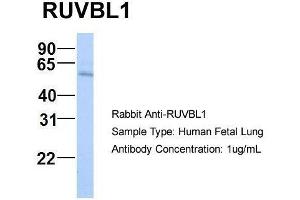 Host:  Rabbit  Target Name:  RUVBL1  Sample Type:  Human Fetal Lung  Antibody Dilution:  1. (RUVBL1 anticorps  (N-Term))