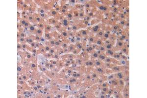 IHC-P analysis of liver tissue, with DAB staining. (IL18RAP anticorps  (AA 396-548))