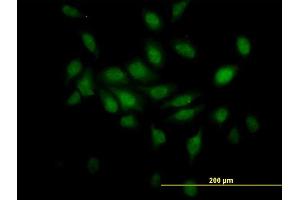 Immunofluorescence of monoclonal antibody to TCEB2 on HeLa cell.