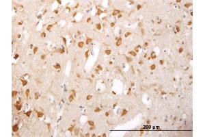 Immunoperoxidase of monoclonal antibody to TRIM25 on formalin-fixed paraffin-embedded human cerebral cortex.