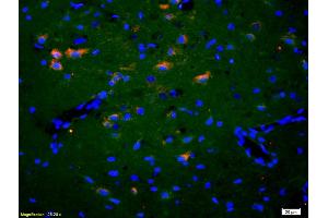 Formalin-fixed and paraffin-embedded rat brain labeled with Anti-EphA2/Eph receptor A2 Polyclonal Antibody, Unconjugated (ABIN669201) 1:200, overnight at 4°C, The secondary antibody was Goat Anti-Rabbit IgG, Cy3 conjugated used at 1:200 dilution for 40 minutes at 37°C. (EPH Receptor A2 anticorps  (AA 901-976))