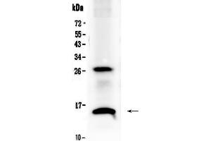 Western blot analysis of SDF1 using anti-SDF1 antibody .