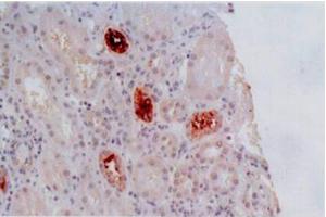 Immunohistochemistry of paraffin-embedded sections (kidney) Immunohistochemistry staining of kidney allograft biopsy (paraffin-embedded sections) with anti-human HLA-G (MEM-G/2). (HLAG anticorps)