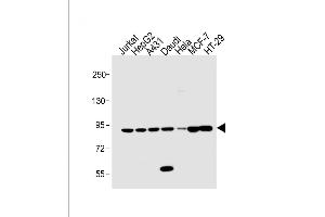 All lanes : Anti-STAT1 Antibody (C-term) at 1:1000 dilution Lane 1: Jurkat whole cell lysate Lane 2: HepG2 whole cell lysate Lane 3: A431 whole cell lysate Lane 4: Daudi whole cell lysate Lane 5: Hela whole cell lysate Lane 5: MCF-7 whole cell lysate Lane 5: HT-29 whole cell lysate Lysates/proteins at 20 μg per lane.