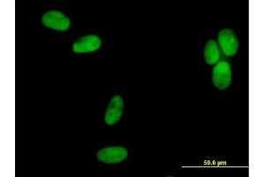 Immunofluorescence of purified MaxPab antibody to POLD2 on HeLa cell. (POLD2 anticorps  (AA 1-469))