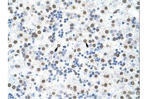 Image no. 1 for anti-Musashi Homolog 2 (MSI2) (AA 37-86) antibody (ABIN203056)