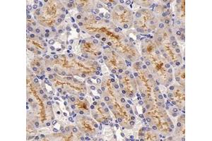 Immunohistochemistry analysis of paraffin-embedded rat kidney using,SLC22A1 (ABIN7075663) at dilution of 1: 1200 (SLC22A1 anticorps)