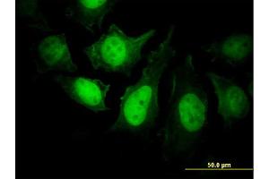 Immunofluorescence of monoclonal antibody to PPP3R1 on HeLa cell.