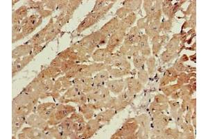 Immunohistochemistry of paraffin-embedded human heart tissue using ABIN7145258 at dilution of 1:100