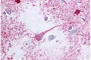 Anti-PTGER3 / EP3 antibody  ABIN1049255 IHC staining of human brain, cortex.