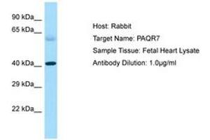 Image no. 1 for anti-Progestin and AdipoQ Receptor Family Member VII (PAQR7) (C-Term) antibody (ABIN6750220) (PAQR7 anticorps  (C-Term))
