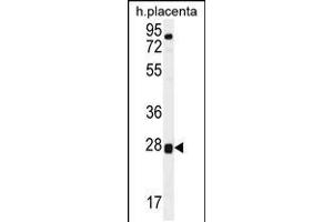 Western blot analysis in human placenta tissue lysates (35ug/lane). (TOR2A anticorps  (AA 194-221))