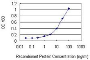 Detection limit for recombinant GST tagged MYO3B is 0. (MYO3B anticorps  (AA 280-369))