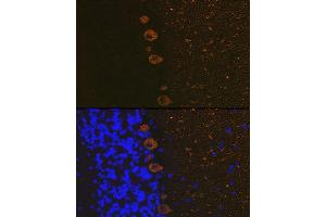 Immunofluorescence analysis of rat brain using IP3R Rabbit mAb (ABIN1679064, ABIN3018927, ABIN3018928 and ABIN7101690) at dilution of 1:100 (40x lens).