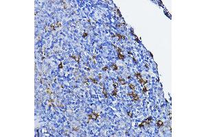 Immunohistochemistry of paraffin-embedded rat spleen using LCK Rabbit pAb (ABIN3023129, ABIN3023130, ABIN3023131 and ABIN6219404) at dilution of 1:100 (40x lens).