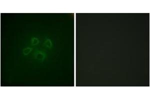 Immunofluorescence analysis of HepG2 cells, using GRB10 (Ab-67) Antibody. (GRB10 anticorps  (AA 33-82))