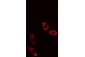 ABIN6275977 staining Hela cells by IF/ICC. (CCZ1B anticorps)