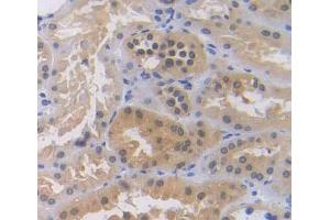 Used in DAB staining on fromalin fixed paraffin- embedded Kidney tissue (ZNF10 anticorps  (AA 1-244))