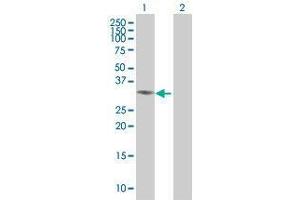 Lane 1: BCL11A transfected lysate ( 26. (BCL11A 293T Cell Transient Overexpression Lysate(Denatured))