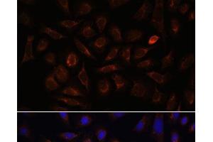 Immunofluorescence analysis of U-2 OS cells using NRP1 Polyclonal Antibody at dilution of 1:100. (Neuropilin 1 anticorps)