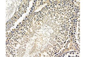 ABIN7096656 and ABIN7100721 at 1/100 staining rat testis tissue by IHC-P. (CHRND anticorps)