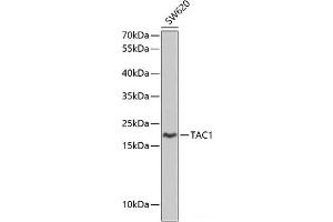 Western blot analysis of extracts of SW620 cells using TAC1 Polyclonal Antibody at dilution of 1:1000. (TAC1 anticorps)