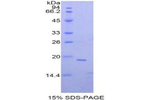 SDS-PAGE analysis of Mouse NME4 Protein. (Non Metastatic Cells 4, Protein NM23A Expressed In Protéine)