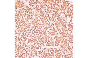 Immunohistochemistry of paraffin-embedded rat ovary using MEK3 antibody (ABIN6130544, ABIN6143484, ABIN6143485 and ABIN6223650) at dilution of 1:100 (40x lens). (MAP2K3 anticorps  (AA 1-170))