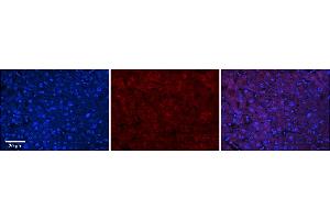 Rabbit Anti-ABHD14A Antibody  Catalog Number: ARP67925_P050 Formalin Fixed Paraffin Embedded Tissue: Human Adult Liver  Observed Staining: Cytoplasm in hepatocytes, weak signal, wide tissue distribution  Primary Antibody Concentration: 1:100 Secondary Antibody: Donkey anti-Rabbit-Cy3 Secondary Antibody Concentration: 1:200 Magnification: 20X Exposure Time: 0.