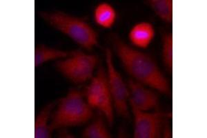 Immunofluorescenitrocellulosee of human HeLa cells stained with Hoechst 3342 (Blue) for nucleus staining and monoclonal anti-human GAPDH antibody (1:500) with Texas Red (Red). (GAPDH anticorps  (AA 1-335))