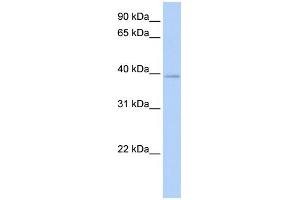 WB Suggested Anti-HOXC10 Antibody Titration:  0. (HOXC10 anticorps  (N-Term))