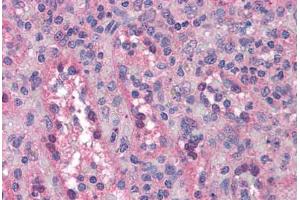 Human Spleen: Formalin-Fixed, Paraffin-Embedded (FFPE)