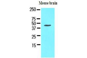 The extracts of mouse brain (50ug) were resolved by SDS-PAGE, transferred to NC membrane and probed with anti-human Homer1 (1:1000). (HOMER1 anticorps)