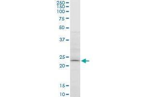 ATG5 monoclonal antibody (M05), clone 1E7. (ATG5 anticorps  (AA 176-275))
