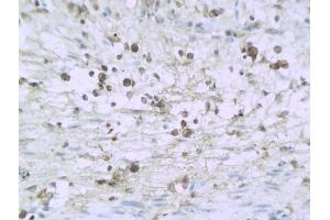 Formalin-fixed and paraffin embedded mouse enterocolitis labeled with Anti-IL-32/NK4 Polyclonal Antibody, Unconjugated (ABIN748298) followed by conjugation to the secondary antibody and DAB staining (IL32 anticorps  (AA 151-234))