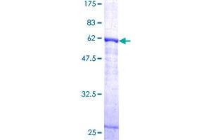 Image no. 1 for Cathepsin K (CTSK) (AA 15-329) protein (GST tag) (ABIN1350722)