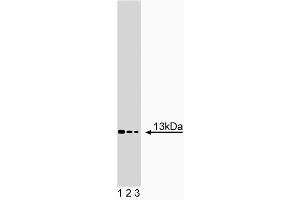 Western blot analysis of Acid Ceramidase on NHEK lysate. (ASAH1 anticorps  (AA 88-182))