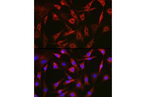 Immunofluorescence analysis of NIH-3T3 cells using FAK Rabbit pAb (ABIN6131638, ABIN6146424, ABIN6146426 and ABIN6215254) at dilution of 1:100 (40x lens). (FAK anticorps  (AA 425-660))