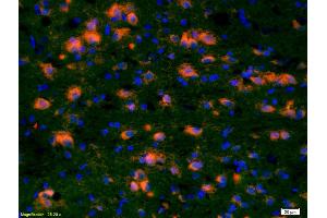 Formalin-fixed and paraffin-embedded rat brain labeled with Anti-CCDC12 Polyclonal Antibody, Unconjugated (ABIN872486) 1:200, overnight at 4°C, The secondary antibody was Goat Anti-Rabbit IgG, Cy3 conjugated used at 1:200 dilution for 40 minutes at 37°C.
