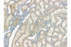 ABIN6265307 and ABIN6278148 at 1/100 staining human normal kidney tissue by IHC-P.