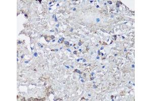 Immunohistochemistry of paraffin-embedded Human lung using NLRC4 Polyclonal Antibody at dilution of 1:100 (40x lens). (NLRC4 anticorps)